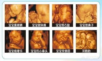 如果胎儿智力有问题，孕妈在孕期有哪些特殊的症状？