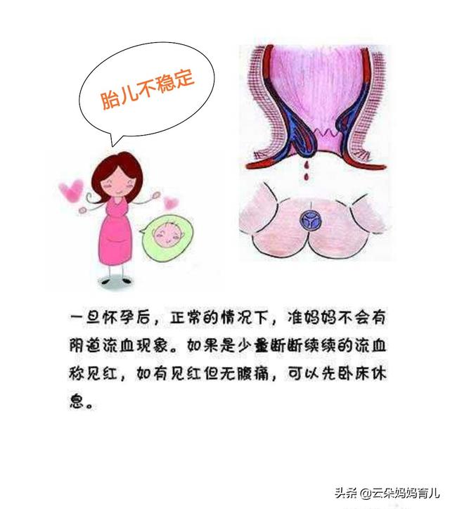 女性的怀孕时间是从什么时候开始算的？这方面有哪些要注意的？