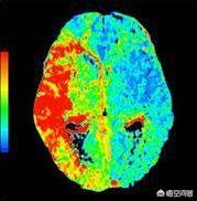 人类进化出那么智慧的大脑，却只开发了一小部分这种说法是真的吗？