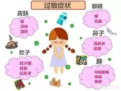 小儿对食物过敏如何鉴别？